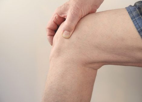 پارگی مینیسک زانو چه عوارضی را در پی دارد؟ 2
